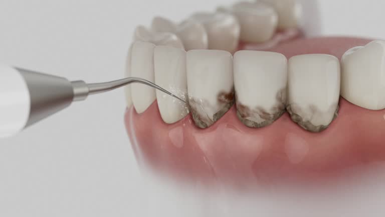 Reliable Dental contractor in Newark, OH by Dentist Open Now